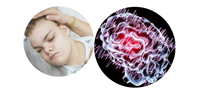 PRINCIPAIS DOENÇAS DO SISTEMA NERVOSO: EPILEPSIA