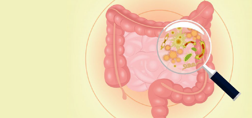 Síndrome do Intestino Irritável