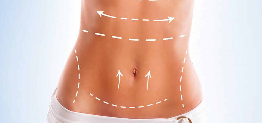 Vai fazer a tão sonhada cirurgia plástica?